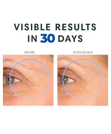 Consult Beaute XTERNA-Q Anti-Aging Universal Day and Night CoQ10 Cream Face Moisturizer and Serum for Dry Skin DUO - Peptide Q10, Niacinamide - Restore Skin Barrier - Visibly Reduce Lines & Wrinkles - Buy Online on GoSupps.com