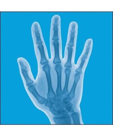 Lindberg Joint Support Supplement for Men and Women | 210 Capsules | with Turmeric MSM Glucosamine Chondroitin Boswellia Extract | Triple Action Complex Blend | Non-GMO Gluten Free - Buy Online on GoSupps.com