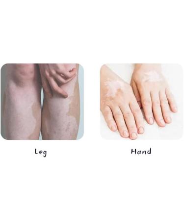 (Two Packs)Psoralea Corylifolia Skin Revitalizing Balm - External Use Tone Repair Cream for Uneven and White Spot Care - Buy Online on GoSupps.com