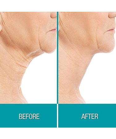 Dermactin-TS Crepe Be Gone Firming Neck and Decollete Cream 3 oz with Three (3) Firming Neck Masks Set - Buy Online on GoSupps.com