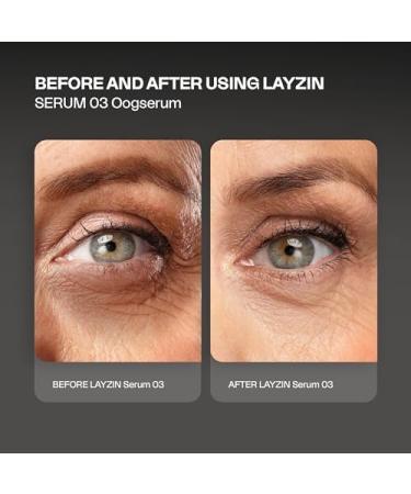  Layzin SERUM 03 for radiant eye area | against dark circles swelling pigment spots and wrinkles | strengthens collagen matrix and elastic | care with patented peptide complex | 30 ml - Buy Online on GoSupps.com