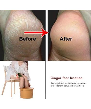 10pcs Ginger Foot Soak Effervescent Tablets Foot Care Mallalah Anti-Swelling Foot Spa Promote Metabolism Eliminate Fatigue Improve Sleeping Foot Pain Foot Care Treatment - Buy Online on GoSupps.com
