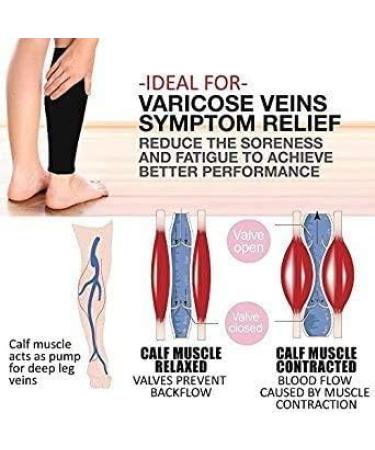 OGIMA Compression Stockings for Varicose Veins Open Toe 20-30 mmHg Medical Gradient Compression Leg Patches for Running Cycling Basketball & CrossFit - Unisex - Buy Online on GoSupps.com