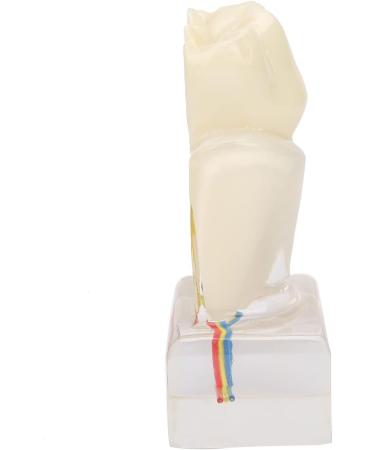 Professional Dental Nerve Model for Teaching | Resin Tooth Model for Students | International Shipping - Buy Online on GoSupps.com