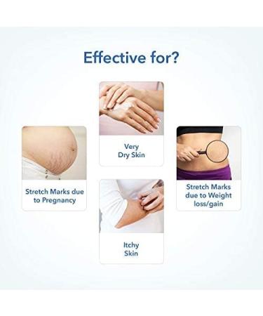 The Moms Co. Natural Body Butter for Stretch Marks Dry Skin and Itchy Skin with Shea and Cocoa Butter 100g - Buy Online on GoSupps.com