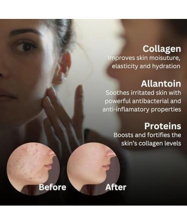 RainbowSnail - 3 in 1 Snail Mucin Skincare Set - Snail Face Serum Snail Sheet Mask Sunscreen SPF Moisturiser Face Women Snail Moisturiser Korean Skincare Gift for her Eczema - Buy Online on GoSupps.com