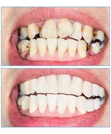 Buy Wffy 4 Pairs Cosmetic Veneer Teeth - Instant Dental Silicone Tooth Whitening Prosthesis for Men & Women - Premium Denture Covers - Buy Online on GoSupps.com