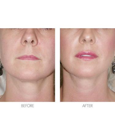 Aloe vera gel for face - Anti-Wrinkle Pills - anti wrinkle supplement (2 Bottles - 120 Capsules) - Buy Online on GoSupps.com