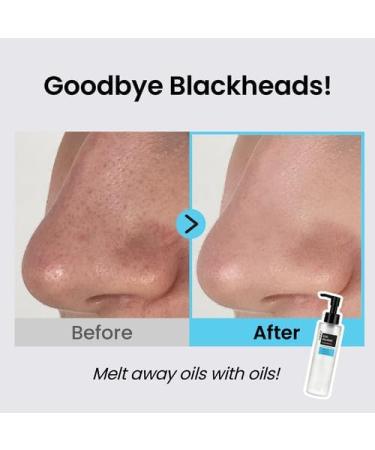  Coxir Ultra Hyaluronic Cleansing Oil 150ml (5.07 fl.oz.) | Deep Cleaning and Hydration | Cruelty Free No Mineral Oil - Buy Online on GoSupps.com