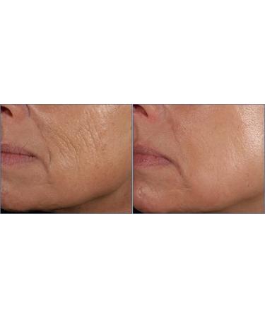 Su-Skin Growth Factor Hyaluronic Acid Serum - Anti Aging with BIO Placenta for Firming Hydration | International Shipping - Buy Online on GoSupps.com