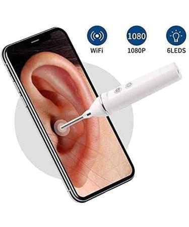 Yannies 3.9mm WiFi Ear Wax Removal Endoscope 5MP Camera - Pink | Portable Visual Ear Cleaner for Adults, Kids & Pets - Buy Online on GoSupps.com