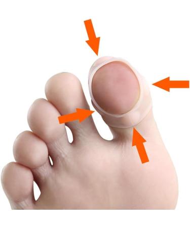 HEALLILY Ingrown Toenail Tool Toenail Corrector Patch Paronychia Toenail Treatment Tape Toenail Correction Sticker Paronychia Recover Foot Care Tool 3 Pairs - Buy Online on GoSupps.com