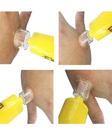 LIVABIT Venom Extractor Suction Pump Kit | Snake Bite & Bee Sting Emergency First Aid for Hiking, Camping, Backpacking | Insect Sting & Rattlesnake Bite Treatment + Bonus CPR Shield 17 Piece Set - Buy Online on GoSupps.com