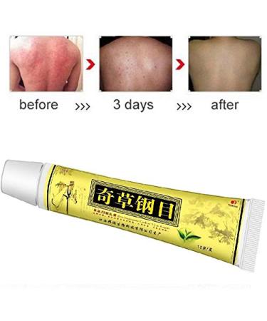 Dermatitis Relief Cream | Soothes Itching & Inflammation | External Use Only - 1Pcs - Buy Online on GoSupps.com