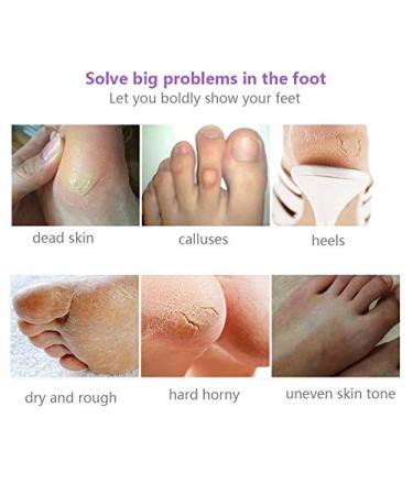 efero Peeling Foot Masks - Remove Dead Skin & Achieve Smooth Heels | Pedicure Socks for Soft Feet - Buy Online on GoSupps.com