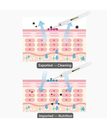 Face Skin Scrubber Facial Cleaner Peeling Vibration Blackhead Removal Exfoliating Pore Cleaner Tools Rechargeable - Buy Online on GoSupps.com