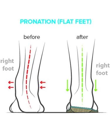 FootScientific Type 1 Orthotic Shoe Insoles for Flat Feet - Men's 8-8.5 / Women's 10-10.5 - Buy Online on GoSupps.com