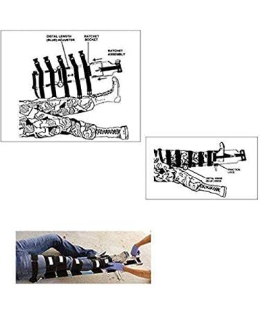Traction Splint Leg Traction Device Orthopaedic Emergency Ambulance Stretcher with 4 Leg Straps Carry Bag Adjustable Ankle Straps Telescoping Design Adult or Children Decoration - Buy Online on GoSupps.com