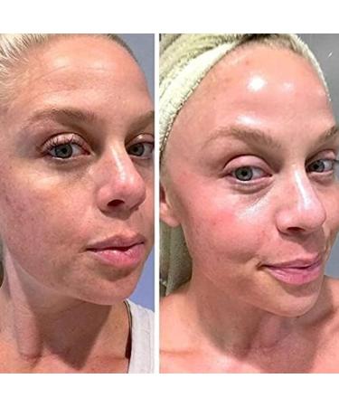 Retinol Gel 0.05 Vitamin A Repairs Fine Lines & Wrinkles Scar Treatment Age and Sun Spots Anti-Aging Formula 20 Grams (0.05) - Buy Online on GoSupps.com