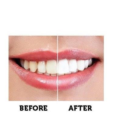 Activated Charcoal Teeth Whitening Kit - Fluoride-Free Organic Whitening Powder & Toothpaste for White Teeth - Best Teeth Whitening Products for a Bright Smile - Buy Online on GoSupps.com