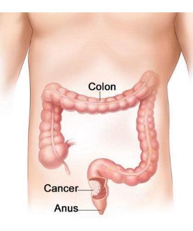 Miracle Oxy-Colon Cleanse Vegan Colon Cleanser - 2 Bottles - 120 Vegetarian Capsules - Buy Online on GoSupps.com