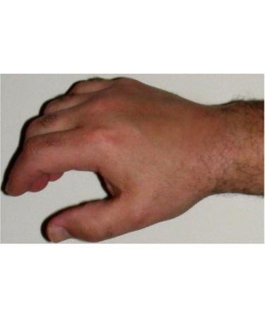 Avosil Scar Care Gel 340.2g | Effective Scar Treatment Solution - Buy Online on GoSupps.com