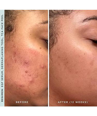 Hydrating EGF Face Serum Lightweight Epidermal Growth Factor Facial Serum for Smooth Skin Texture & Radiance Fast-Absorbing Plant-Based Formula (1 fl oz) - Buy Online on GoSupps.com