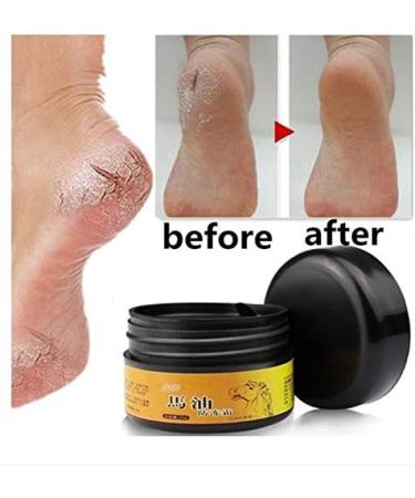 Bsttai Foot Cream - Ultimate Foot Care for Dry Itchy Skin | Hydrating Foot Balm & Mushroom Treatment - Buy Online on GoSupps.com