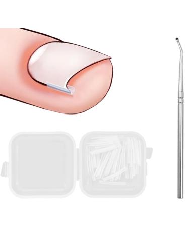 KINDOYO Correction Ingrown Toenails Set - 40 Pieces Painless Toenail Smoothing Strips with Toenail Lifter - Simple Tool Set for Ingrown Toenails