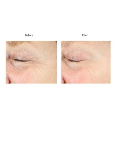 Bluelene EyePlus+ a new formula powered by the ultimate trifecta of Methylene Blue Ergothioneine and Niacinamide. Dermatologist approved. Suitable for Sensitive Skin. - Buy Online on GoSupps.com