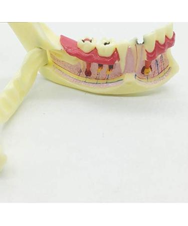 Ernzi Lower Jaw Decomposition Model - Realistic Dental Simulation & Teaching Tool for Oral Health Education - Buy Online on GoSupps.com