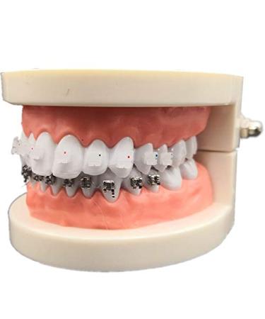 Dental Orthodontic Treatment Model with Ortho Metal Ceramic Bracket Arch Wire Buccal Tube Ligature Ties