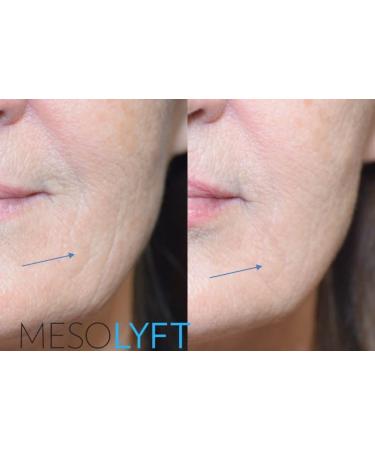 Power Combo Neck & Eye Roller - Brightening Anti-Aging Face Serums & Best Lip Plumper for Multi-Purpose Skin Care - Buy Online on GoSupps.com