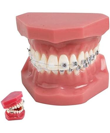 BAUR Dental Organ Model - Orthodontic Teeth Model for Dentists | Metal & Ceramic Oral Demonstration - Buy Online on GoSupps.com