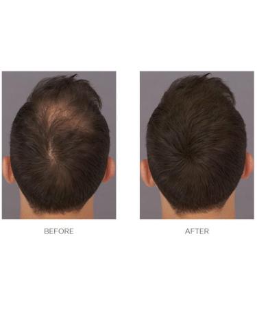 Fiber Stick Spray - Best Perfect Fiber Lock Spray - Natural-Looking Results - Elevate Your Hair Styling - Buy Online on GoSupps.com