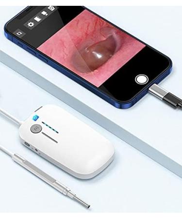 SMSOM OTOSKOK 100MP HD Ear Wax Removal Camera - 6 LED Lights & 3.9mm Ear Cleaner Tool - Buy Online on GoSupps.com