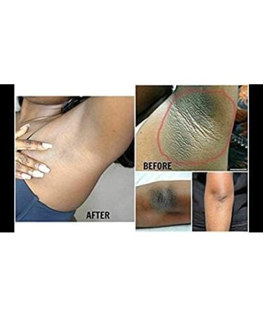  BEROZA Skin Lightening Cream for Dark Spots on Face Underarms Neck and Groin Women's Underarm Whitening Cream Cream to Lighten Underarms and Intimate Areas 50ml Whitening Cream - Buy Online on GoSupps.com