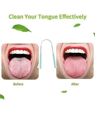 Rjsqaqe High-Quality Steel Tongue Cleaner Brush - Best Tongue Hygiene Tool for Oral Care - Buy Online on GoSupps.com