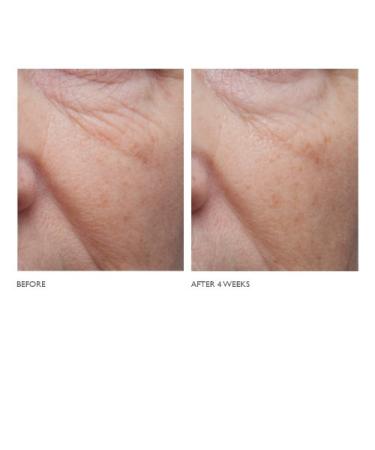 Kate Somerville Age Arrest Anti-Wrinkle Cream | Advanced Anti-Aging Moisturizer | 1.7 Fl Oz - Buy Online on GoSupps.com