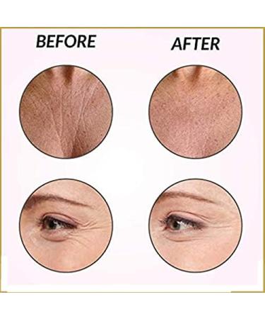 YANGYANGDA Wrinkles Patches Chest Wrinkle Pads Anti-Wrinkle Reusable Silicone Patches Facial Wrinkle Remover Strips Wrinkle Patches for Face Neck and Chest (A) - Buy Online on GoSupps.com