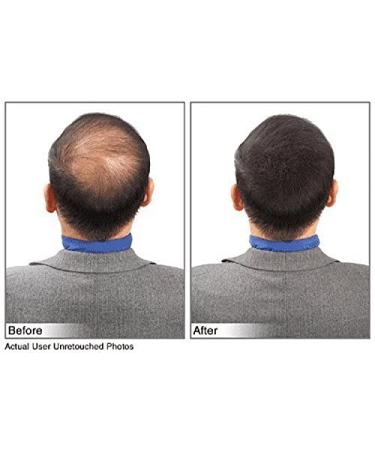 Large 28g Hair Building Fibers - Conceal Thinning Hair & Bald Spots - Undetectable & Washes Away - For All Hair Types - No Animal Byproducts (Black) - Buy Online on GoSupps.com