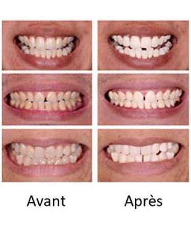 Teeth Whitening Kit Whitens and protects enamel Professional teeth whitening Certified and clinically tested gel ECLAWHITE - Buy Online on GoSupps.com