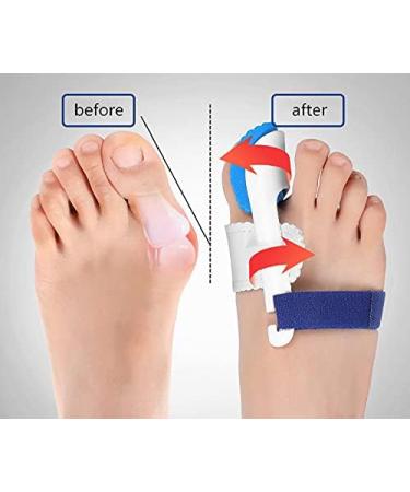 Grand Toe Valgus Corrector - Relieve Pain Separate Toes & Smooth Hammer Toe | Non-Surgical Orthopedic Solution - Buy Online on GoSupps.com