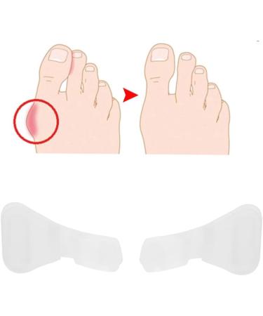 Bunion & Hammer Toe Correctors + 5 Pairs of Silicone Toe Separators for Foot Alignment & Appearance - Buy Online on GoSupps.com