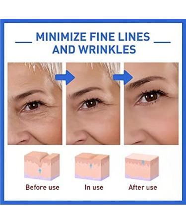 Botoxlux Collagen Anti Aging Serum - Instant Face Tightening | Wrinkle Cream | Bot_ox Stock Solution - 5pcs - Buy Online on GoSupps.com