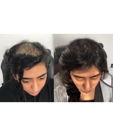 Gold Banner Beauty Good2Gro Hydrating Shampoo - Strengthening Silk Protein Formula 8oz | Vegan Cruelty-Free & Restorative Cleanser - Buy Online on GoSupps.com