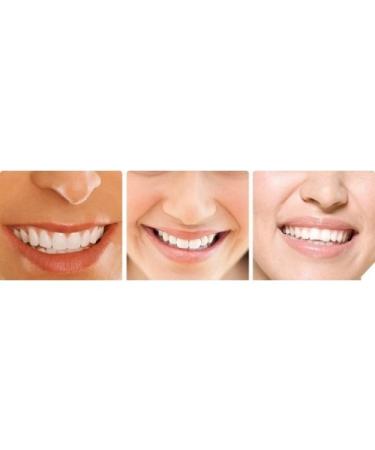 Extra Strength Teeth Whitening Kit - 12 Syringes of 44% Gel, 2 Mouth Trays - Buy Online on GoSupps.com
