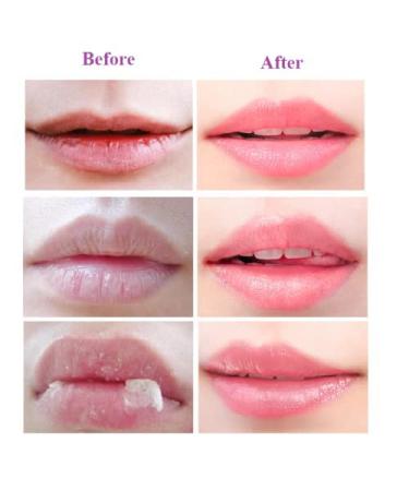 Bee Balm Honey Lip Mask Set for Hydrating and Exfoliating Lips - Buy Online on GoSupps.com