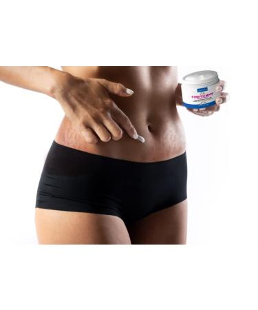 LURE Essentials Fade Stretch Marks Cream with Cocoa Butter - Pregnancy Stretch Mark Remover & Prevention - Buy Online on GoSupps.com