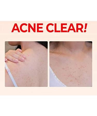[SOME BY MI] AHA.BHA.PHA 30 Days Miracle Clear Body Cleanser 400g - 14.11 oz (1 Pack) - Buy Online on GoSupps.com